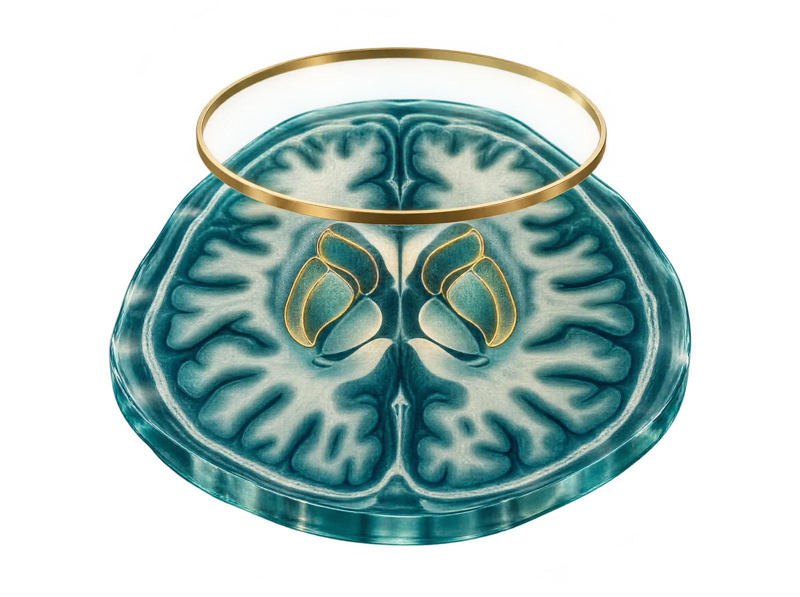 Stilisierte Schnittbildschicht des Gehirns, die Basalganglien golden umrandet, darüber ein goldener Ring als Sinnbild der neurologischen Abklärung.